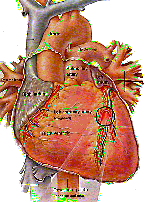heart attack arteriosclerosis risk reducing blood uth typepad arteries legs theart