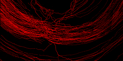 light micrograph of axons in the retina that contain histamine.